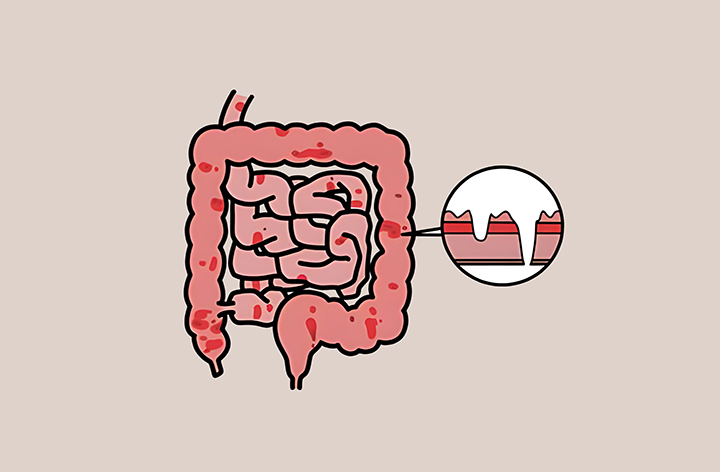 항균-및-항염-작용