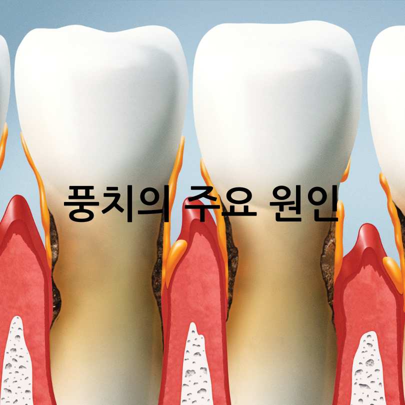 풍치 원인, 증상, 치료법부터 발치