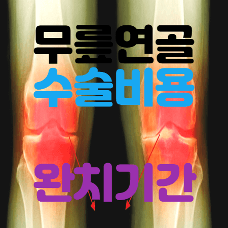 무릎연골 수술이 필요한 무릎의 상태
