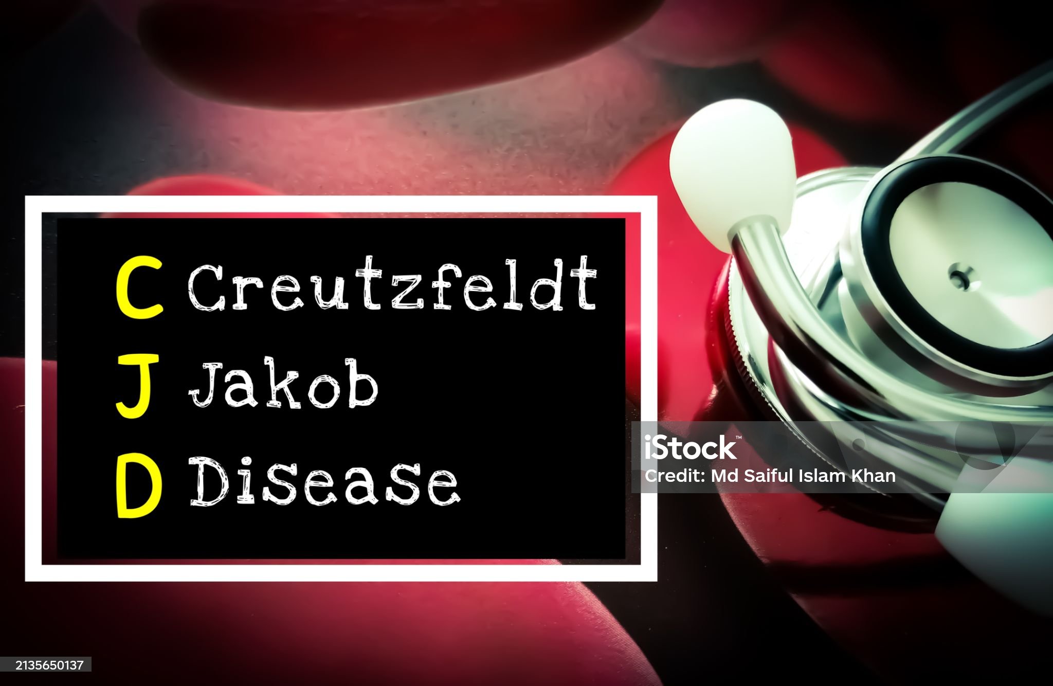 크로이츠펠트-야콥병