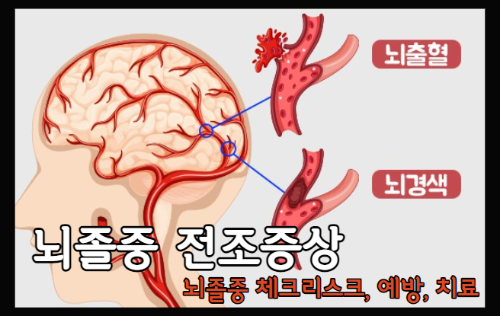 뇌졸중 전조증상과 체크리스트 및 예방과 치료