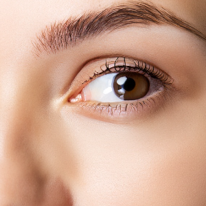 2. 눈떨림의 원인: 영양소 부족