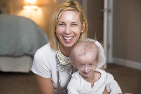 소아조로증 원인