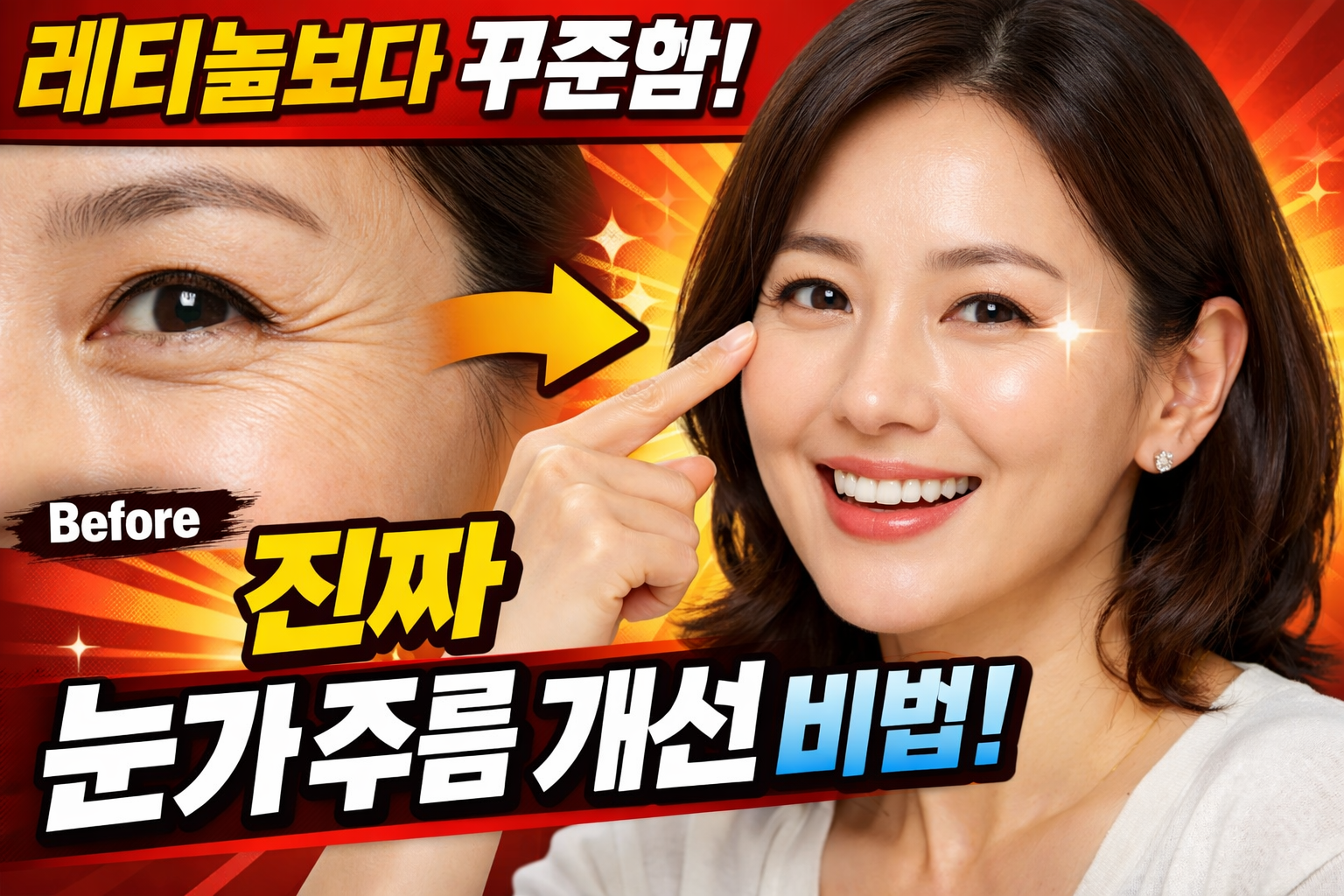 눈가 주름 개선