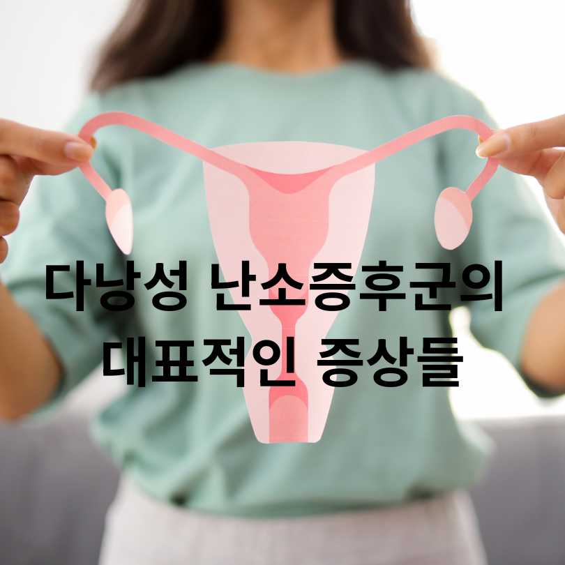 다낭성 난소증후군 증상과 좋은 음식 총정리