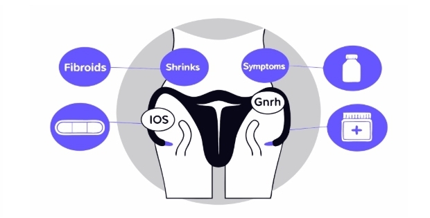 자궁근종 치료 과정