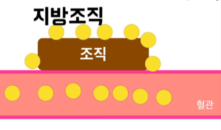 인슐린저항성