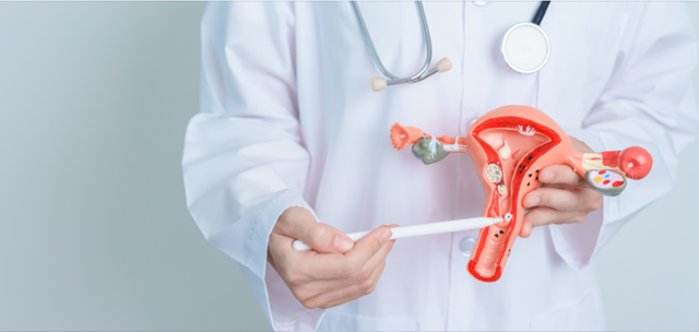 난소낭종, 폐경 후에도 주의가 필요한 이유