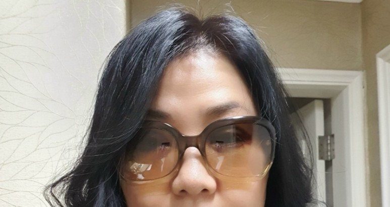 하안검 수술 후기