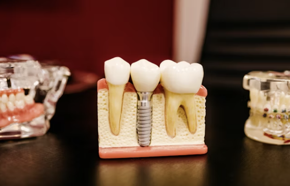 잇몸이 내려 앉을 때 해결법