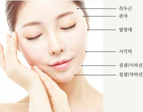 사각턱 보톡스