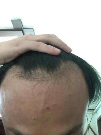 이마가 넓은 여자 관상 특징과 해석_22