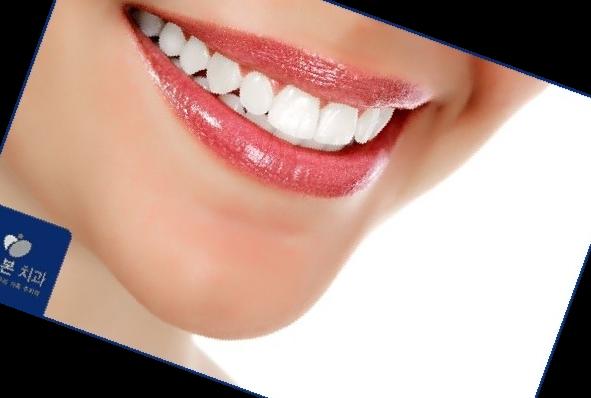 잇몸 내려앉음 치료