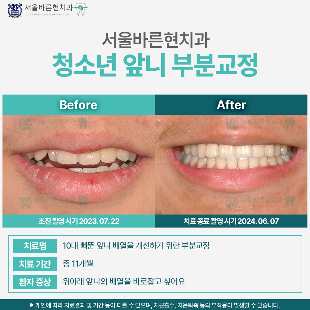 부산청소년교정