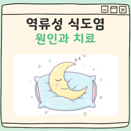 역류성 식도염 원인과 치료 대표 이미지