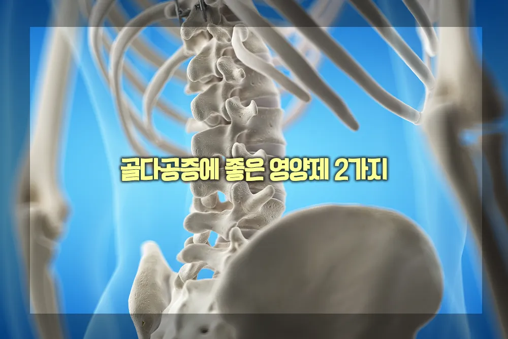 골다공증에 좋은 영양제 2가지