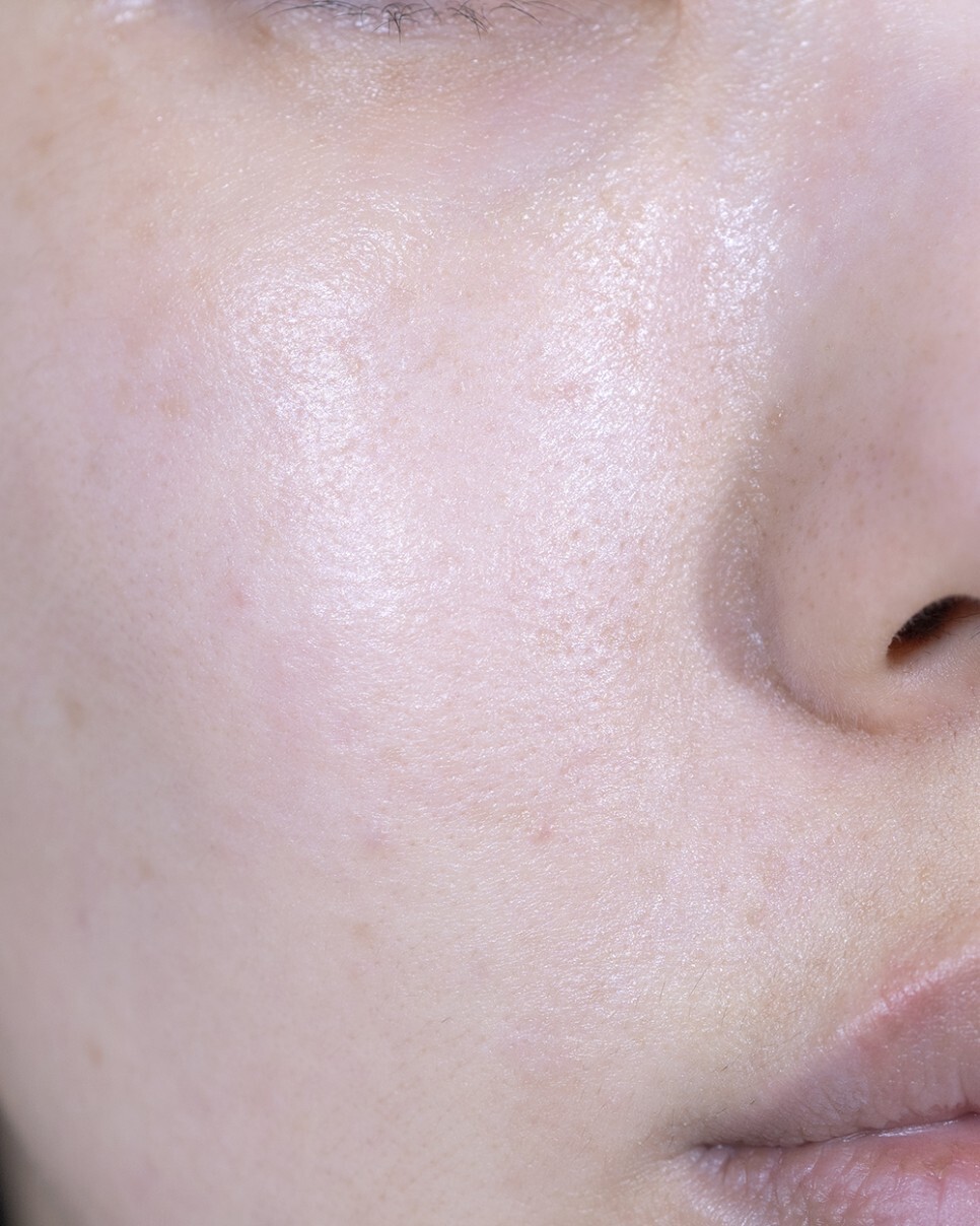 레블라이트 토닝 후기