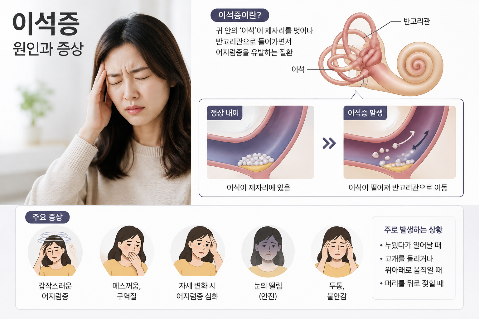 이석증원인
