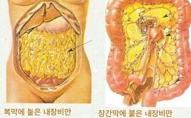 내장지방