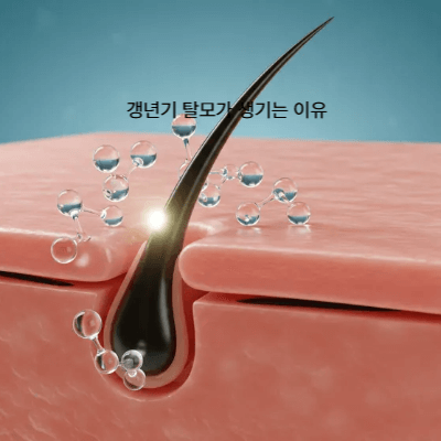갱년기 두피·탈모 원인과 관리법 (2025)|샴푸·영양제·전문 치료까지