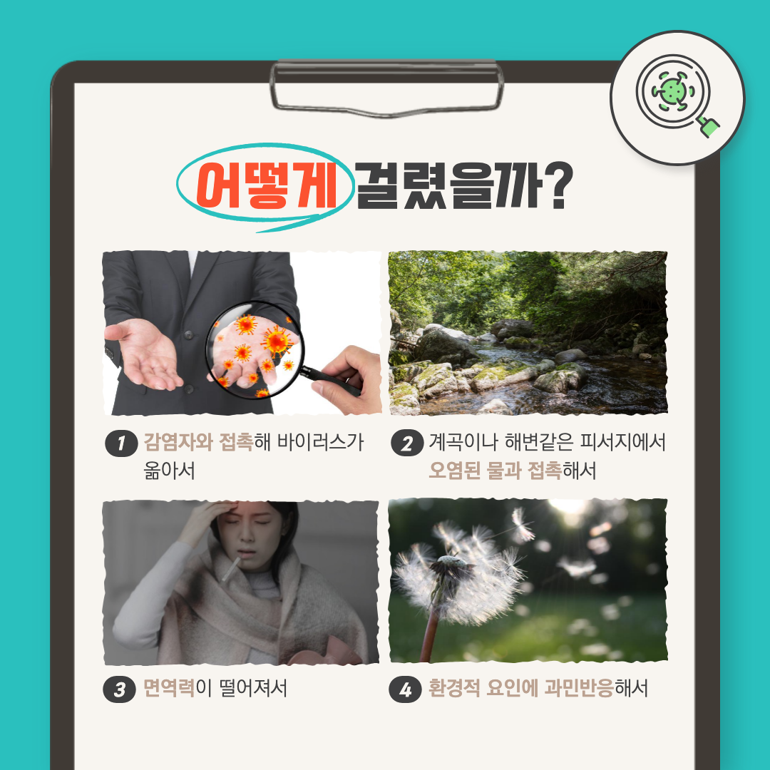 결막염 원인에 대한 설명 이미지.