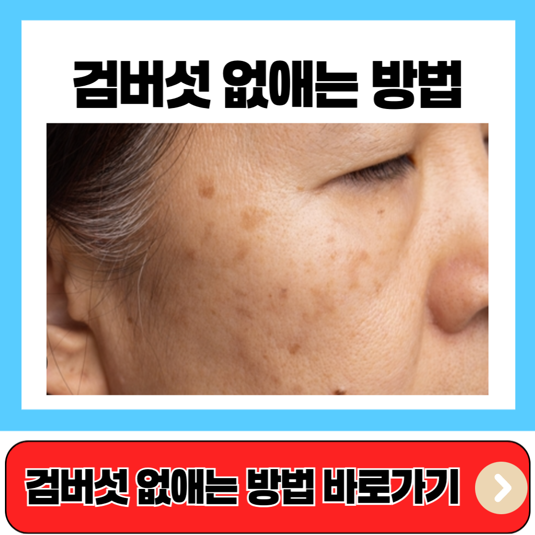 검버섯 없애는 방법