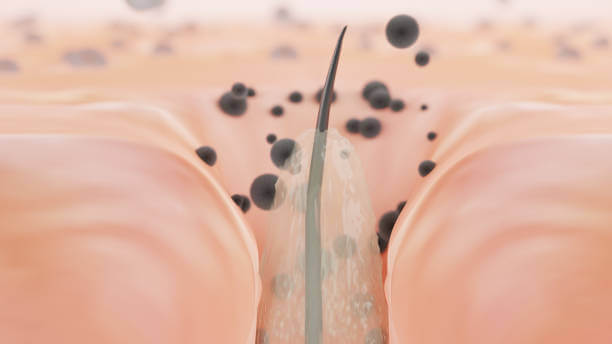 소극성 속모증은 블랙헤드와는 다른 증상이 있습니다. 간혹 콧등이나 콧볼에 작고 검은 점들이 조밀하게 형성되어 있는 것을 보고 보통 블랙헤드이지만&amp;#44; 모공 밖으로 나오는 검은 털인 속극성 속모증이 보이는 경우도 있습니다. 어떤 증상과 원인 치료방법이 있는지 참고하시기 바랍니다. 