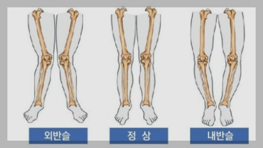 시니어들의 무릎 통증: 원인과 관리 방법