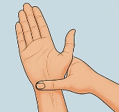 손목터널증후군 증상과 치료법