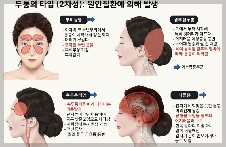 지끈지끈 머리 두통 : 원인과 해결 방법