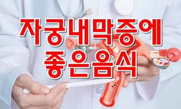 자궁내막증-좋은음식-자궁모형-들고있음