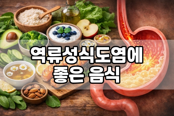 역류성식도염에 좋은 음식