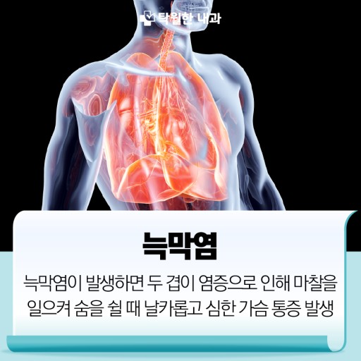호흡기 질환: 늑막염- 원인, 증상, 진단방법, 치료방법, 후유증.