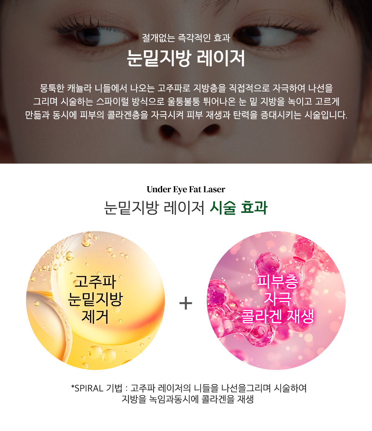 강남 눈밑꺼짐 시술.png