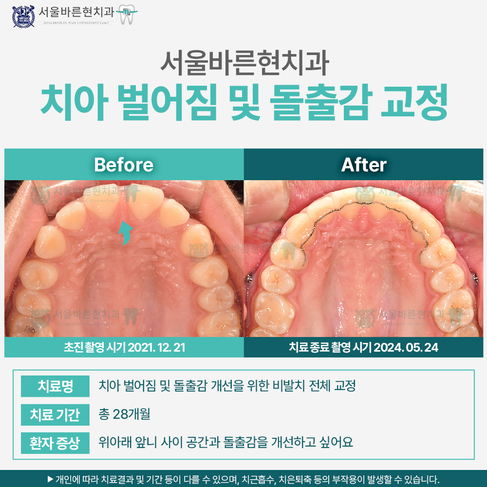 해운대치아교정