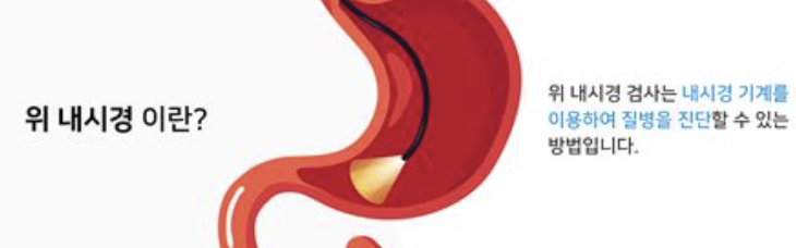 위장내시경 1