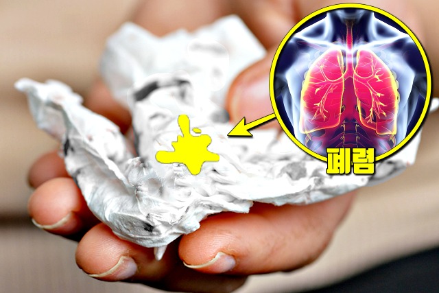 코로나 증상 가래,우한 폐렴 증상,건강