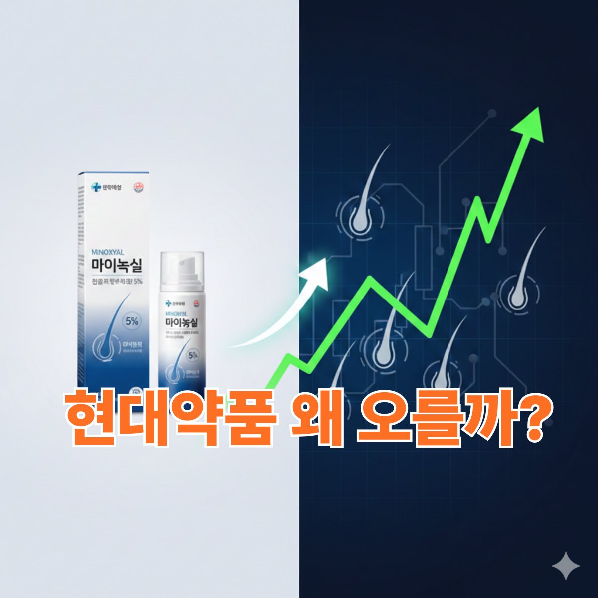 현대약품 탈모 치료제 마이녹실과 주가 상승 이슈를 함께 보여주는 탈모 관련주 분석 썸네일