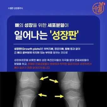 성장판 닫혀도 키 클 수 있는 방법과 성장 호르몬 시기_18