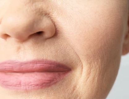 팔자주름 없애기 위한 방법