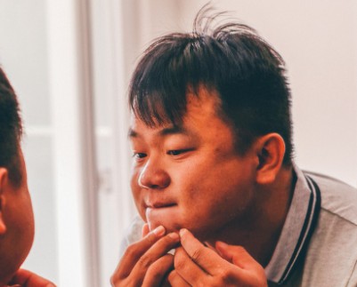 여드름 흉터 자국