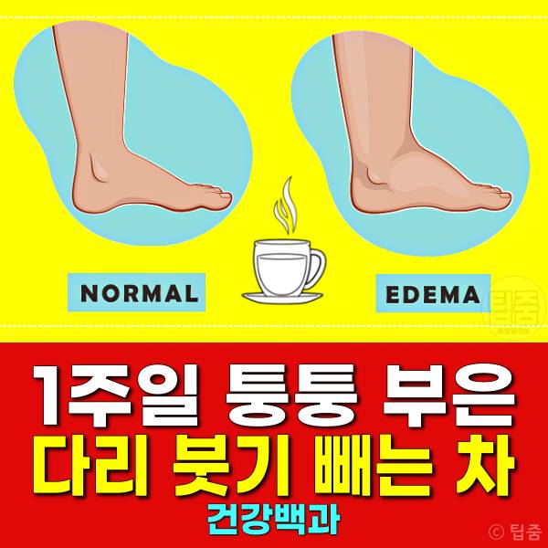 다리붓기 빼는 차 붓기빼는음식