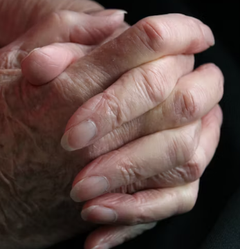 류마티스 관절염 초기증상 치료 원인 예방법