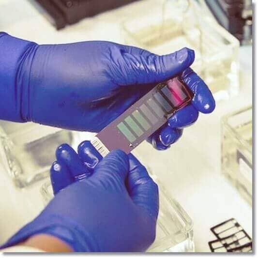 봉와직염 진단과 치료