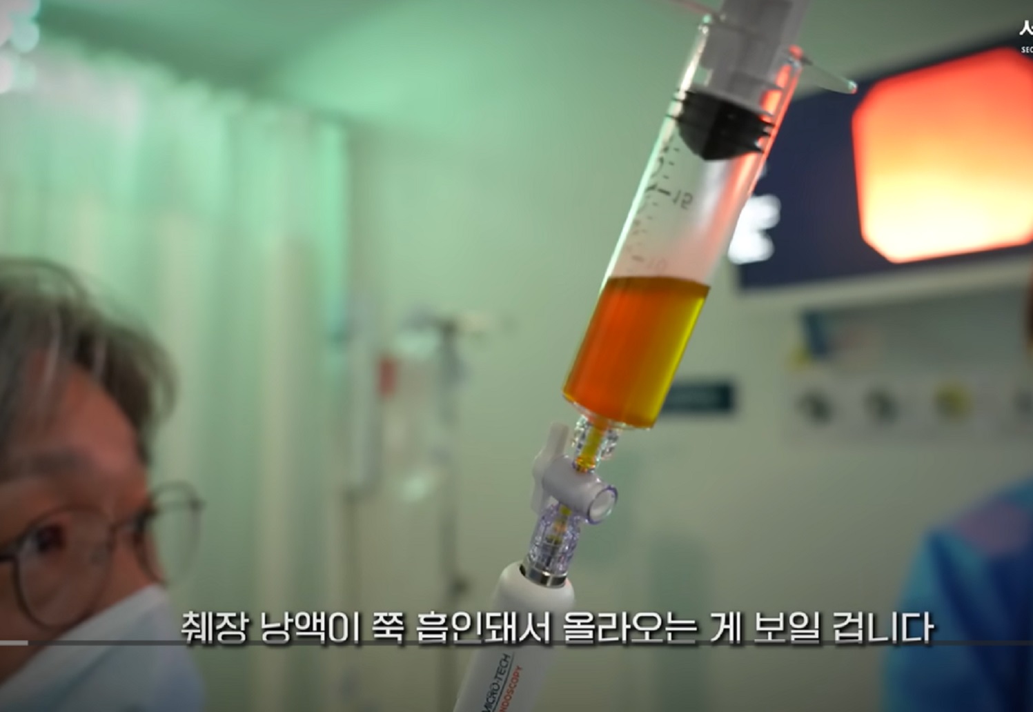 췌장암-명의-이상협-교수