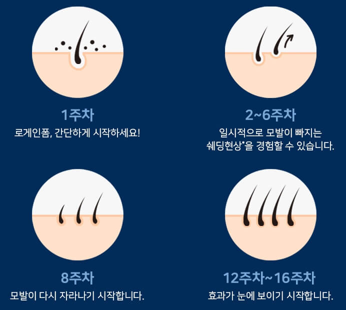 로게인폼 효과