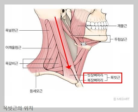 목빗근