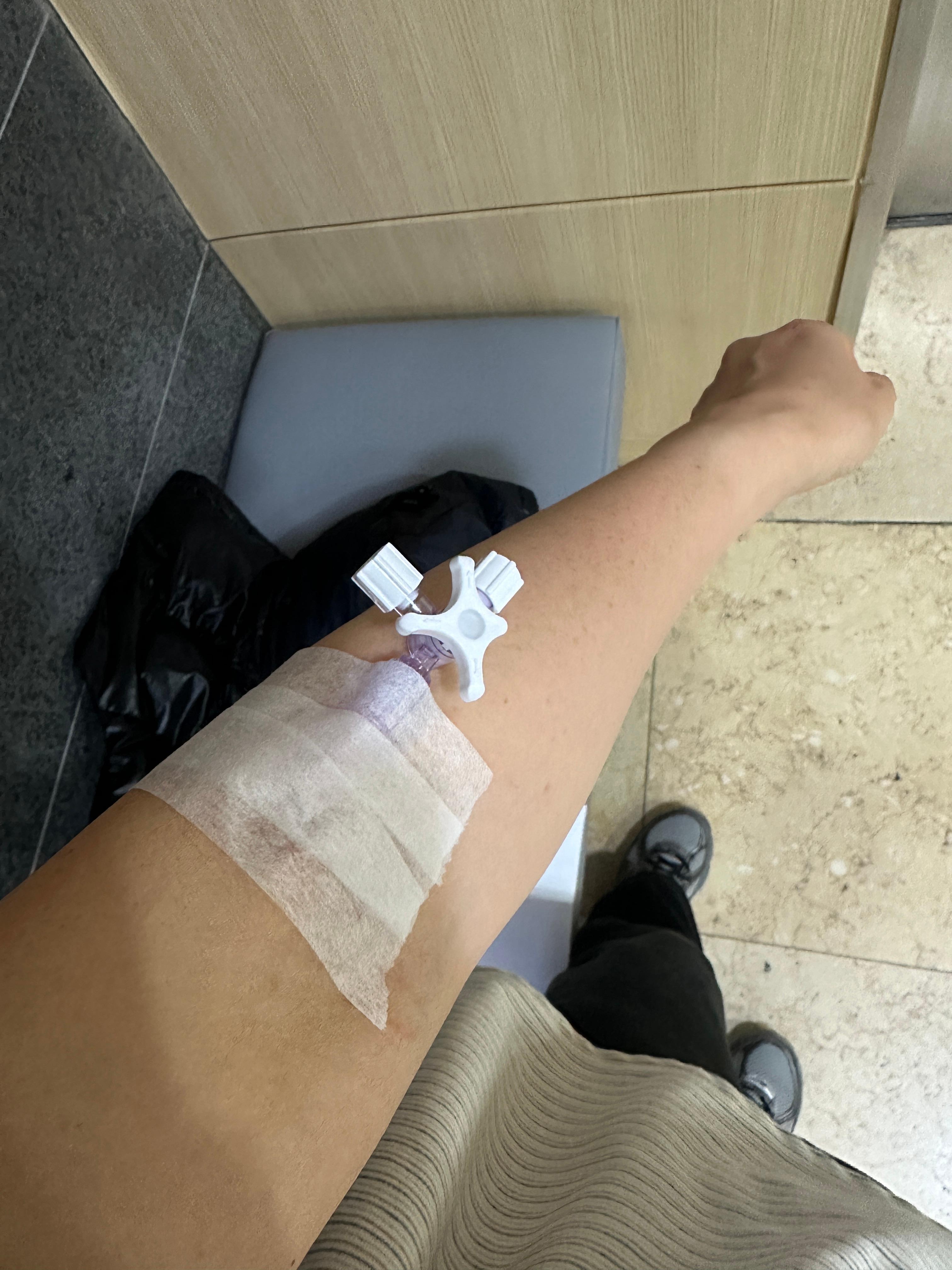 정맥주사 맞은 사진