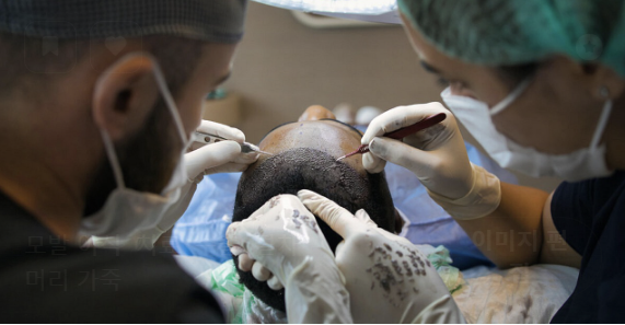 뇌 이식의 미래 — 영화 같은 일이 현실로