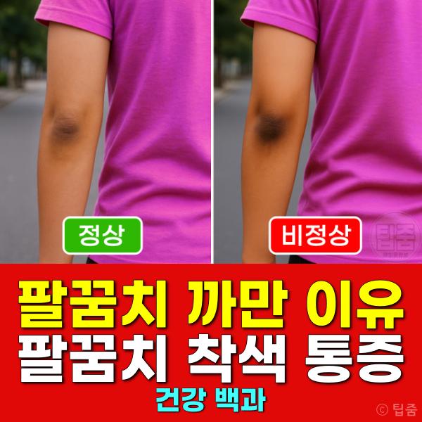 팔꿈치 까만 이유 팔꿈치 착색 통증 찌린 원인